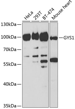 Anti-GYS1 Antibody (CAB2519)