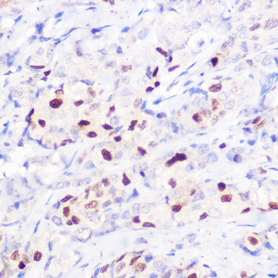 Anti-CDKN1A/p21CIP1 Antibody [KO Validated] (CAB2691)