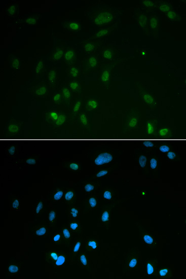 Anti-Chk2 Antibody (CAB2145)