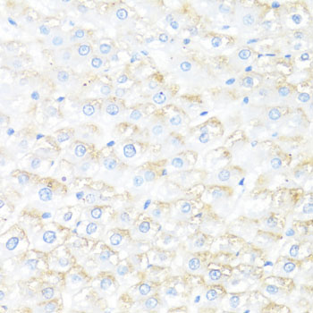 Anti-IL-7 Antibody (CAB1650)