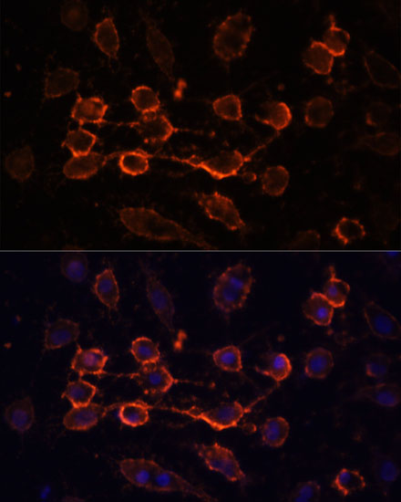 Anti-CD44 Antibody (CAB16807)