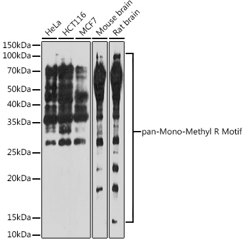 pan-Mono-Methyl Arginine Motif Rabbit Polyclonal Antibody (CAB17984)