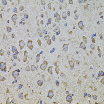 Anti-CRHR1 Polyclonal Antibody (CAB8409)