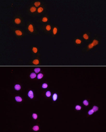 Anti-Rhodamine (TRITC) Goat Anti-Rabbit IgG (H+L) Antibody (CABS040)