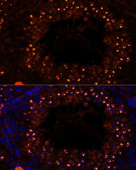 Anti-MSH4 Polyclonal Antibody (CAB8556)