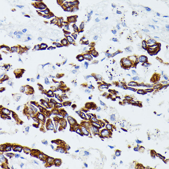 Anti-MMP25 Antibody (CAB15886)