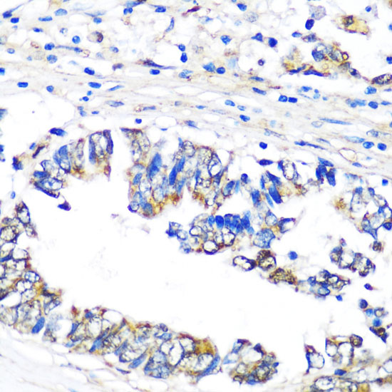 Anti-PBEF / NAMPT Antibody (CAB0256)