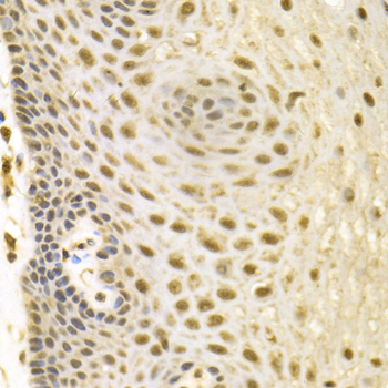 Anti-BAG1 Antibody (CAB1104)