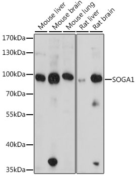 Anti-SOGA1 Antibody (CAB16597)