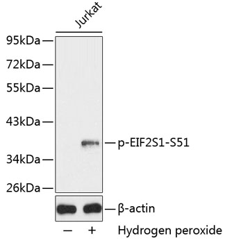 Anti-Phospho-eIF2a-S51 Antibody (CABP0342)