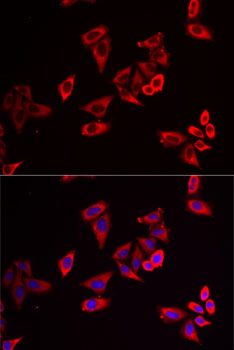 Anti-RPL9 Antibody (CAB6406)