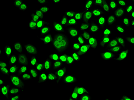 Anti-NUDC Antibody (CAB6678)