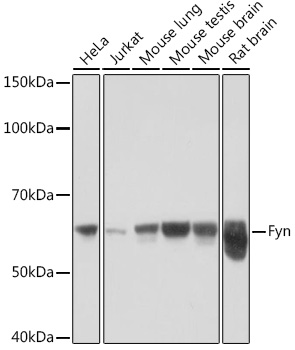 Anti-Fyn Antibody (CAB9165)