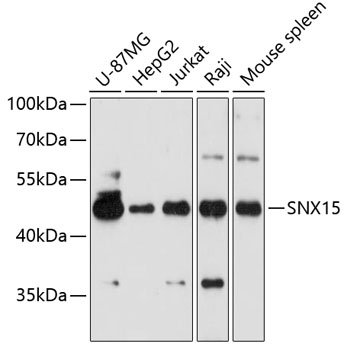 Anti-SNX15 Polyclonal Antibody (CAB9158)