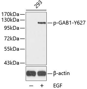 Anti-Phospho-GAB1-Y627 Antibody (CABP0256)