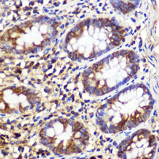 Anti-ATG10 Antibody (CAB7390)