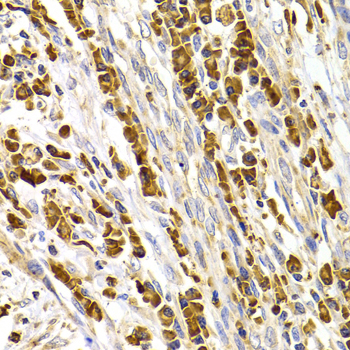 Anti-TACR3 Antibody (CAB7220)