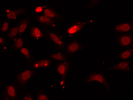 Anti-HNRNPF Antibody (CAB5505)