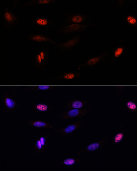 Anti-SUMO3 Antibody (CAB15724)