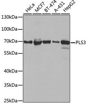 Anti-PLS3 Antibody (CAB3627)