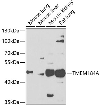 Anti-TMEM184A Antibody (CAB7857)