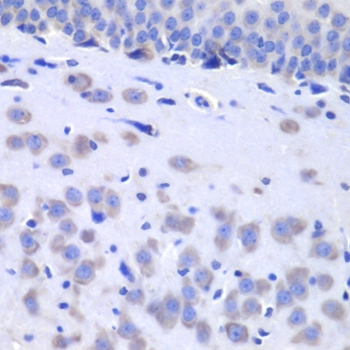 Anti-HTT Antibody (CAB7900)