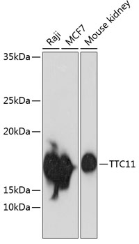 Anti-TTC11 Antibody [KO Validated] (CAB19666)