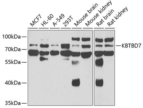 Anti-KBTBD7 Antibody (CAB7392)