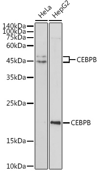 Anti-CEBPB Antibody (CAB0711)