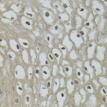 Anti-IL-33 Antibody (CAB12604)