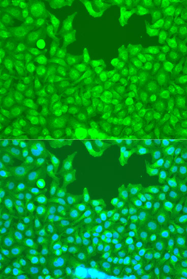 Anti-TAZ Antibody (CAB15806)