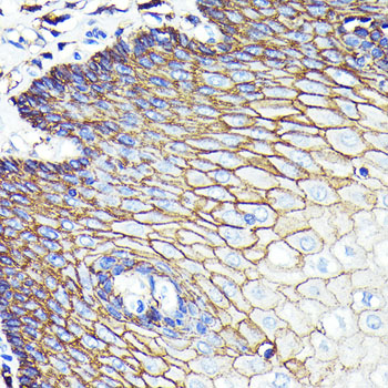 Anti-CD44 Antibody [KO Validated] (CAB19020)