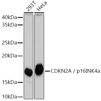 Anti-CDKN2A / p16INK4a Mouse Monoclonal Antibody (CAB18219)