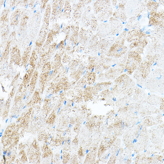 Anti-PDK4 Antibody (CAB13337)