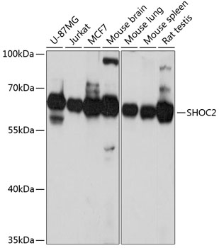 Anti-SHOC2 Antibody (CAB4199)