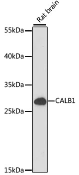 Anti-CALB1 Antibody (CAB15035)