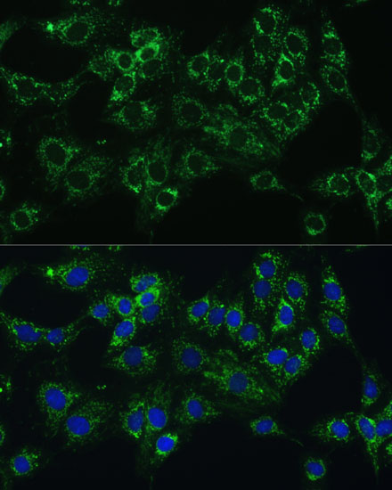 Anti-CYB5A Antibody (CAB5401)