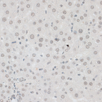Anti-ZNF148 Antibody (CAB7001)