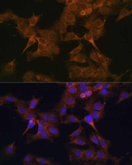 Anti-EIF2B2 Antibody (CAB7027)