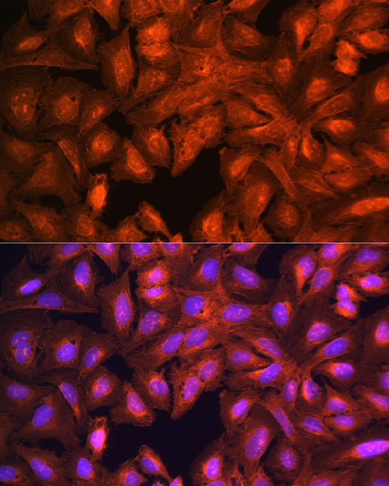 Anti-LASP1 Antibody (CAB3941)