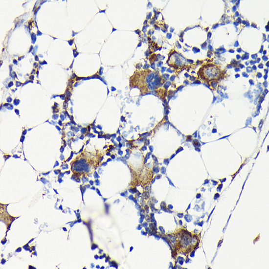 Anti-ITGB3 Antibody (CAB2542)