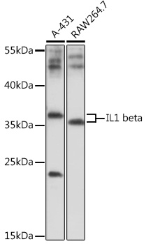 Anti-IL-1 beta Antibody (CAB17361)