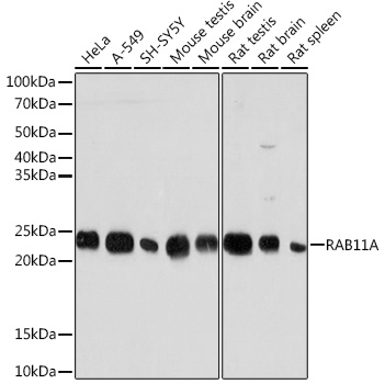Anti-RAB11A Antibody (CAB3251)