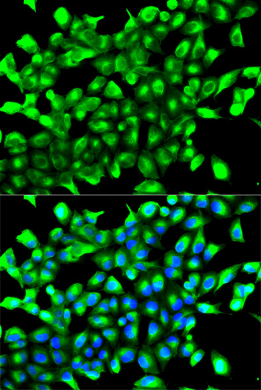 Anti-PHD2 Antibody (CAB2314)