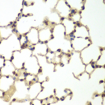 Anti-USF1 Antibody (CAB13560)