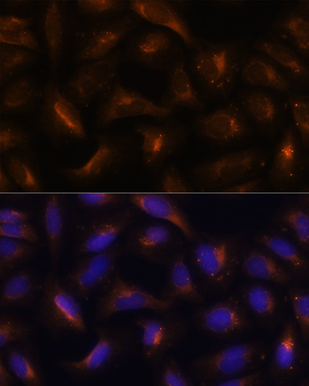 Anti-SQSTM1 Antibody (CAB11246)