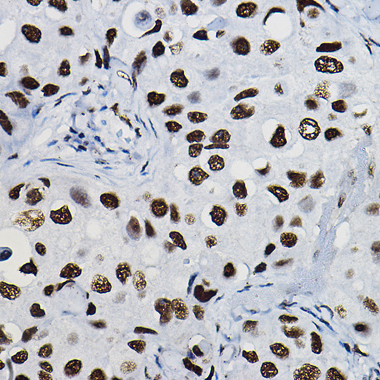 Anti-METTL14 Polyclonal Antibody (CAB8530)