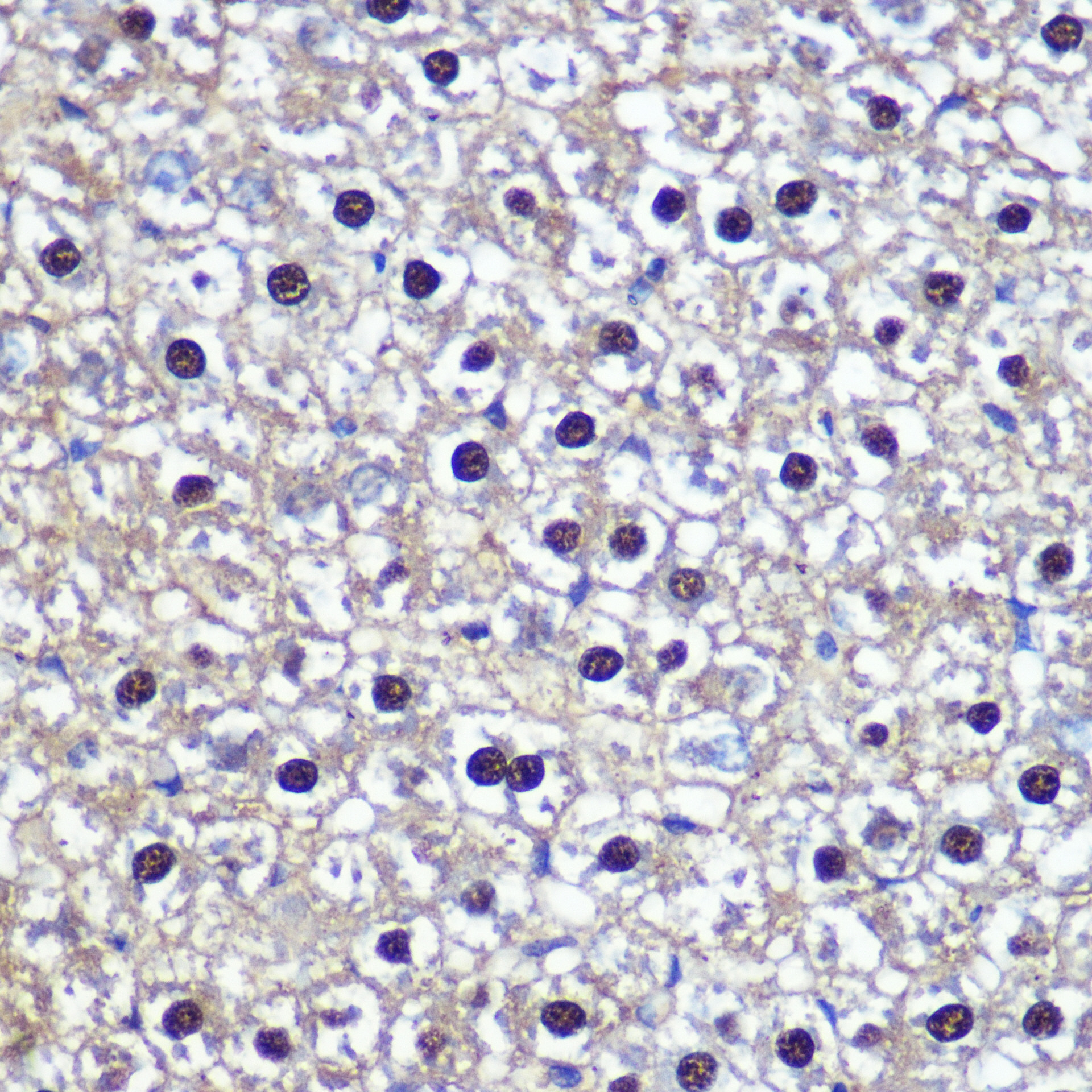 Anti-TK1 Antibody (CAB5612)