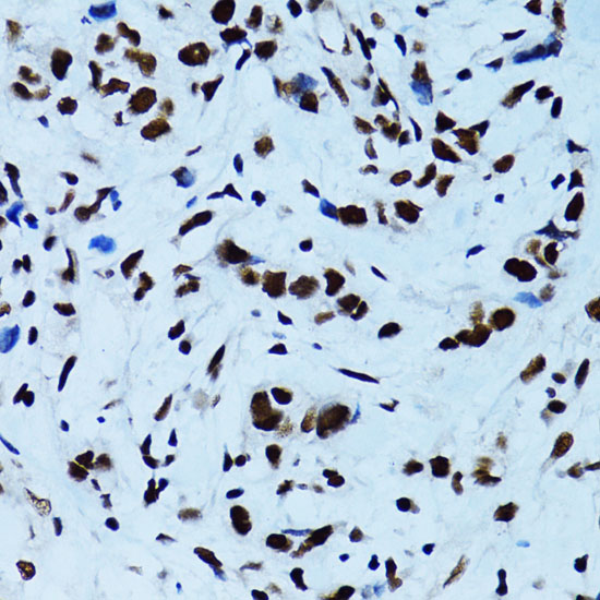 Anti-TARDBP Antibody (CAB0538)