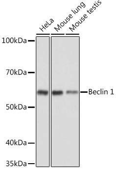 Anti-Beclin 1 Antibody[KO Validated]